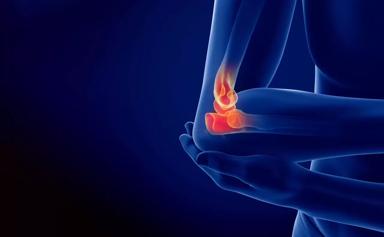 Golferellbogen Was tun gegen Golferarm Golferellenbogen Mediale Epicondylitis Golferarm schmerzhafte Erkrankung durch Überbeanspruchung der Sehnen im Ellenbogen verursacht